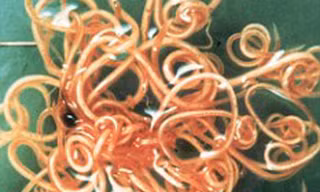 Ăn trứng giun để giảm cân