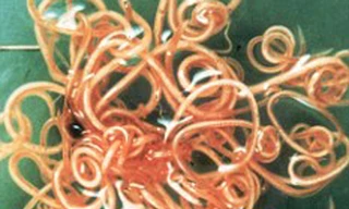 Ăn trứng giun để giảm cân