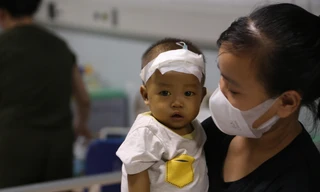 Trung Thu nghẹn nước mắt của những trẻ em nghèo, mắc bệnh bẩm sinh