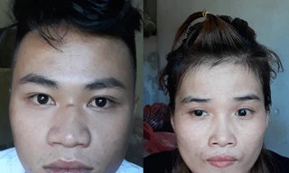 Cướp tiền ở sòng bài rồi dùng dao, súng tấn công làm 5 người bị thương