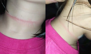 Bé gái 4 tuổi ở Philippines suýt mất mạng khi thực hiện theo thử thách treo cổ trên TikTok