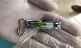 Phú Thọ: Bé gái 9 tuổi học theo clip trên YouTube nuốt bấm móng tay vào bụng