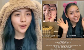 Hot TikToker “trứng rán cần mỡ” vẫn bị dân mạng nghi ngờ dù đã can đảm công khai mặt mộc