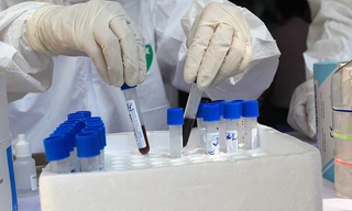 Sáng 31/7 phát hiện thêm 45 ca mắc COVID-19, Đà Nẵng lập bệnh viện dã chiến