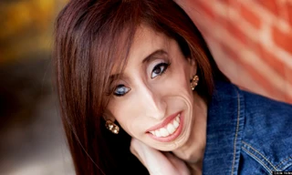 Bản lĩnh phi thường của “cô gái xấu xí nhất hành tinh“