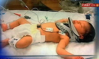 Bé sơ sinh chấn thương sọ não vì bị y tá đánh rơi