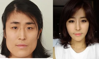 Dở khóc dở cười với các cô nàng 'vịt hóa thiên nga' sau thẩm mỹ