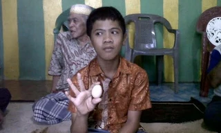 Cậu bé Akmal. Nguồn: Bugma/iNews.