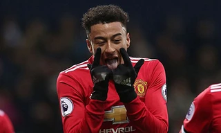 Sao trẻ M.U khoe dây chuyền vàng mô phỏng động tác ăn mừng