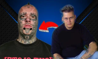 Kinh hãi trước gương mặt của ‘dị nhân’ Đức không tai, phẫu thuật 17 lần cho giống đầu lâu