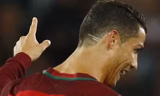 Ronaldo để kiểu tóc mới có 2 vạch sau đầu để ủng hộ cậu bé bị ung thư. (Nguồn: AP)