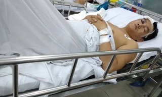 Nam công nhân bị đánh nứt sọ vì mâu thuẫn trong lúc làm việc