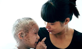 Rơi lệ hình ảnh 'em bé cá'