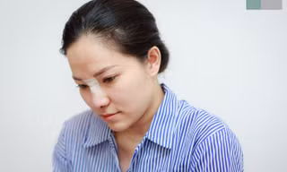 Lý Phương Châu quyết định sửa mũi để đón nhận những điều mới trong cuộc sống.