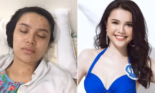 Gương mặt sáng giá Hoa hậu Đại dương có nguy cơ phải bỏ thi