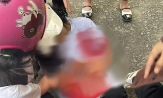 Nữ sinh lớp 10 đâm hai bạn học phải đi cấp cứu