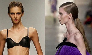 Hãi hùng 'những bộ xương di động' trên sàn catwalk