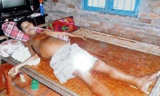 Chữa bệnh hiểm nghèo nhờ nấm lim xanh Tiên Phước