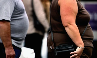 Thừa cân, béo phì làm tăng nguy cơ mắc 11 loại ung thư