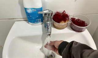 Bệnh nhân Bệnh viện Y học cổ truyền Trung ương phản ánh không đủ nước nóng sinh hoạt