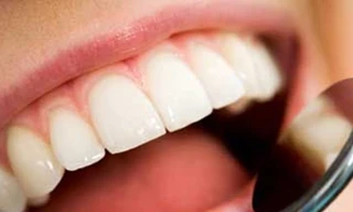 Chăm sóc răng miệng để nụ cười luôn rạng rỡ