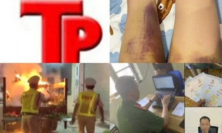 Bản tin Hình sự: Người phụ nữ tố bị chồng cũ đánh nhiều lần ở nhà riêng