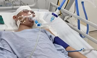 Hà Nội: Nam sinh lớp 8 bị đánh chấn thương sọ não khi chơi bóng rổ