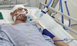 Công an Hà Nội thông tin về vụ học sinh lớp 8 bị đánh chấn thương sọ não, tiên lượng xấu