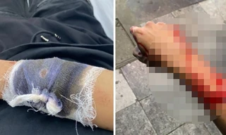 Công an Hà Nội truy lùng toán cướp gây án trước Nhà hát Lớn