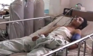 Cứu sống bệnh nhân bị đâm thủng ngũ tạng