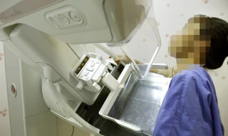 Chẩn đoán sớm để phát hiện ung thư vú Ảnh: Thái Hà 