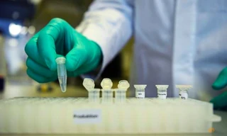 Một nhân viên hãng CureVac đang thử vắc-xin COVID-19 ngày 12/3 ảnh: Reuters