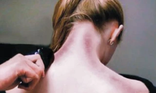 Cạo gió như thế nào cho đúng?