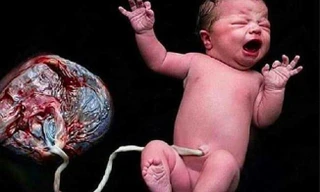 Hàng loạt bác sĩ lên án mạnh mẽ 'sinh thuận tự nhiên'