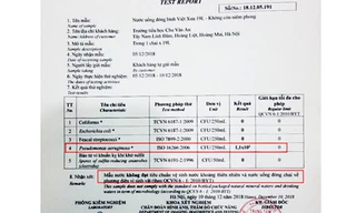 Kết quả thử nghiệm ở Trung tâm kiểm soát bệnh tật. Ảnh: PHCC