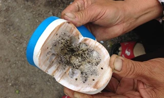 Bà Trần Thị Nguyên với chiếc dép mua ở chợ, bên trong đầy chất lạ màu đen