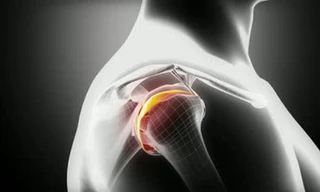 Các chuyên gia Mỹ lần đầu nuôi thành công sụn người đủ chức năng từ tế bào gốc - Ảnh: Shutterstock