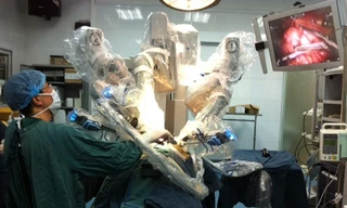 Những cánh tay robot đang tiến hành phẫu thuật nội soi cho em bé. (Ảnh: Thùy Giang/Vietnam+)