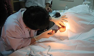 Chế độ ăn cho bệnh nhân trĩ