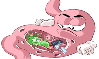 Cách hạn chế những cơn đau dạ dày