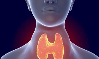 Bệnh tuyến giáp cũng là nguyên nhân gây tăng huyết áp