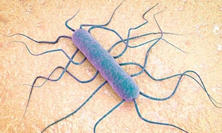Listeria là vi khuẩn gây ra bệnh listeriosi