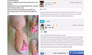 Phương pháp chữa sốt bằng lươn (trái) cho bé được một mẹ bỉm sữa chia sẻ và phương pháp chữa đau mắt bằng sữa mẹ (phải) được truyền tai, hậu quả là một phụ huynh làm theo khiến mắt bé bị nặng hơn. Ảnh: ITN