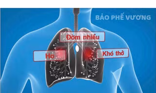 Ho khan, ho đờm là các triệu chứng thường gặp của viêm phế quản