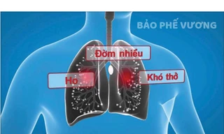 Ho khan, ho đờm là các triệu chứng thường gặp của viêm phế quản