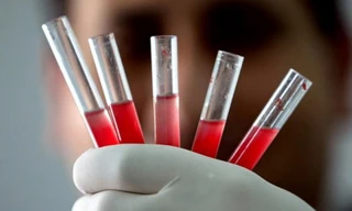 Tạo được tế bào máu và tế bào miễn dịch từ tế bào da