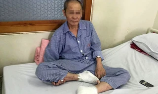 Bệnh nhân bị bỏng nặng ở hai bàn chân. Ảnh: T.N.