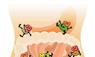 Loạn khuẩn đường ruột sẽ gây rối loạn tiêu hóa