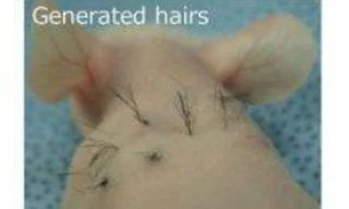 Liều thuốc chữa hói đầu từ khoai tây chiên