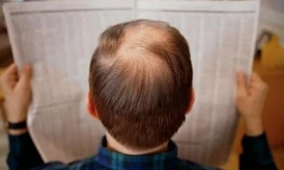 Cách giúp tóc bạc thành tóc đen.